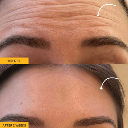 Gua Sha Lymphatic Contour Massager