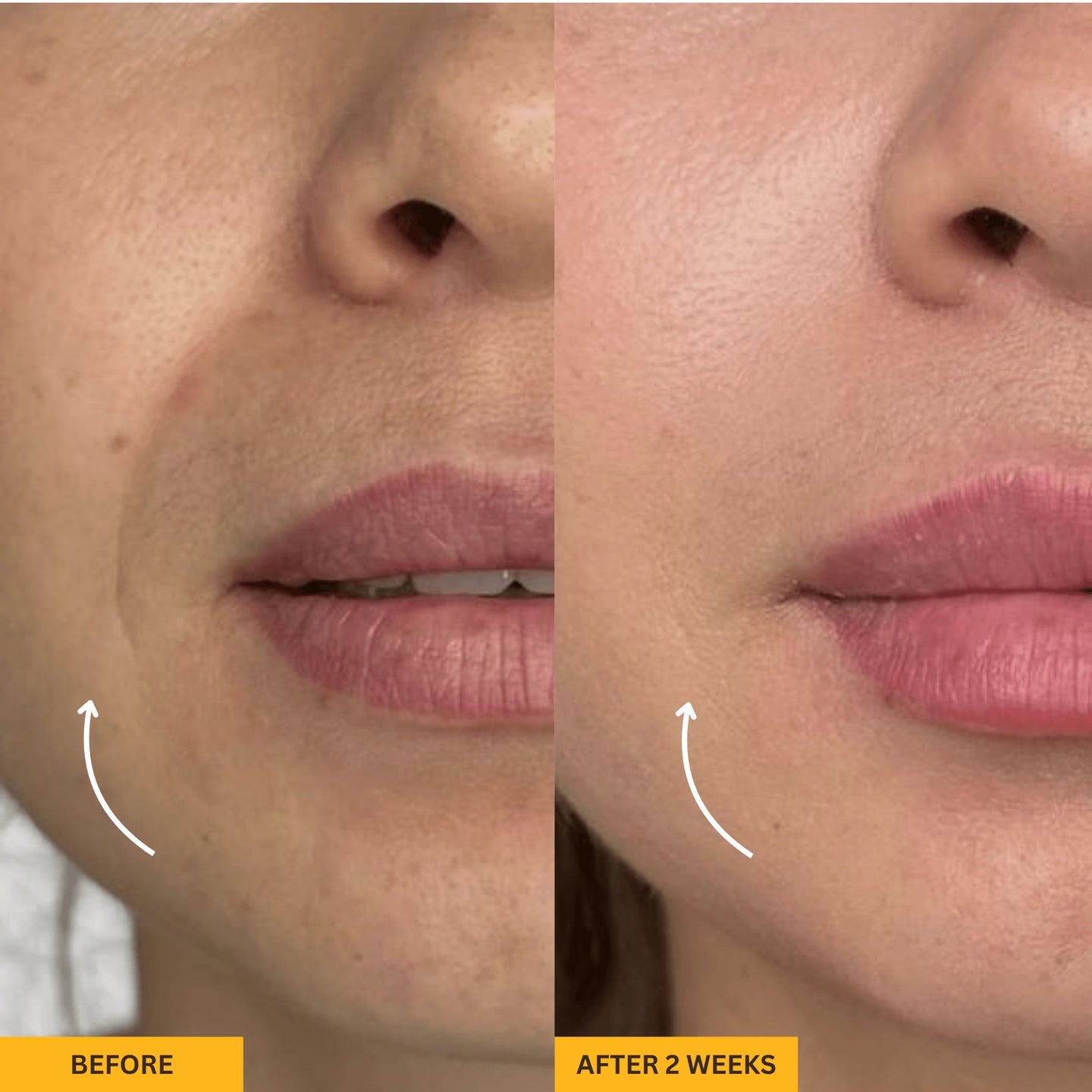 Gua Sha Lymphatic Contour Massager