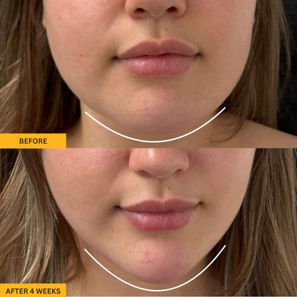 Gua Sha Lymphatic Contour Massager