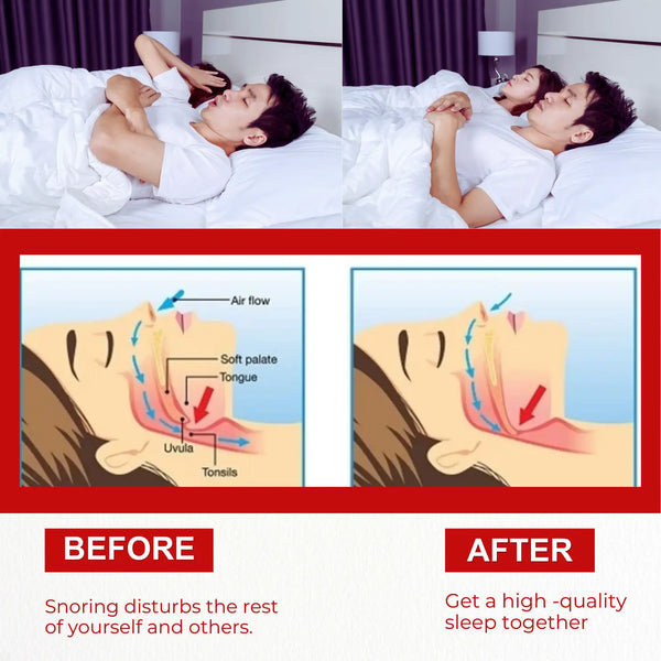 Anti Snoring Nose Clip (BUY 1 GET 1 FREE)